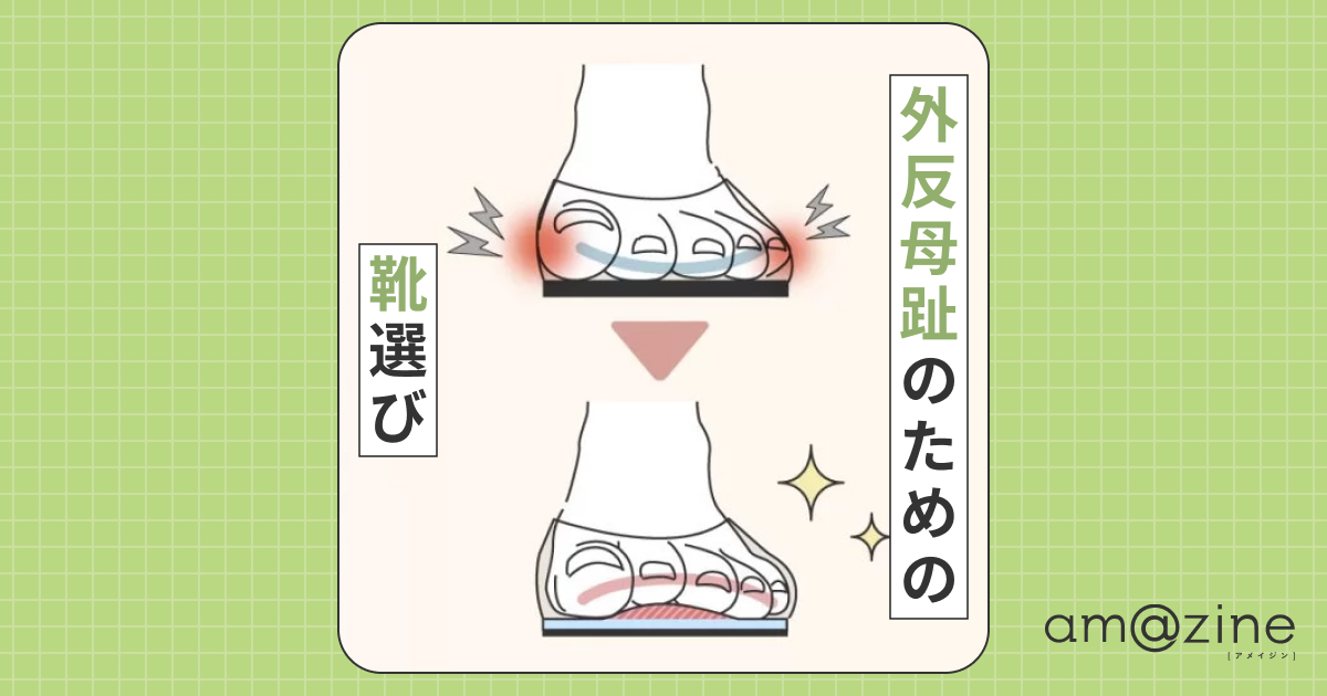 【外反母趾のための靴選び】痛くない、疲れにくい靴とは