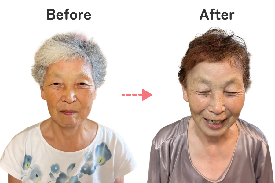 ビフォーアフター