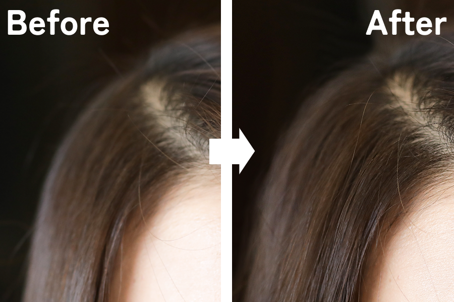 Before・After