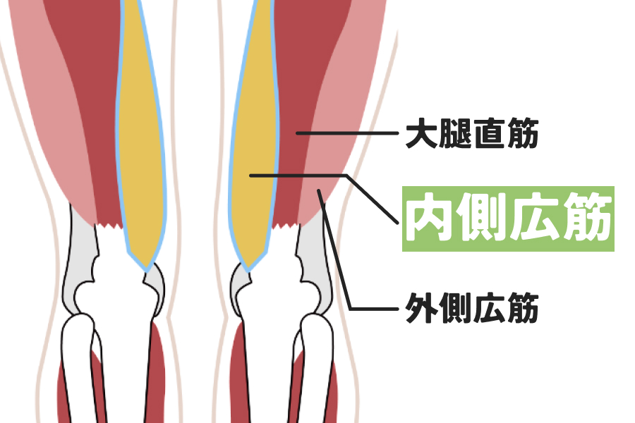 そして、内側広筋は最も衰えやすく、最も鍛えにくいんです。