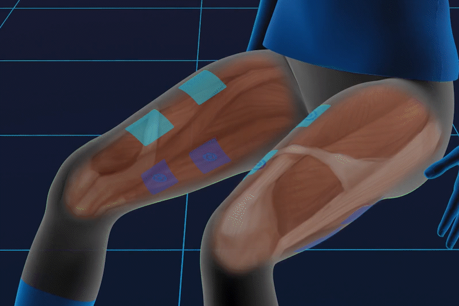 世の中には腹筋用のEMSが多いですが、僕が作りたかったのは、膝の安定に最も重要な内側広筋を狙い撃ちできるものでした。