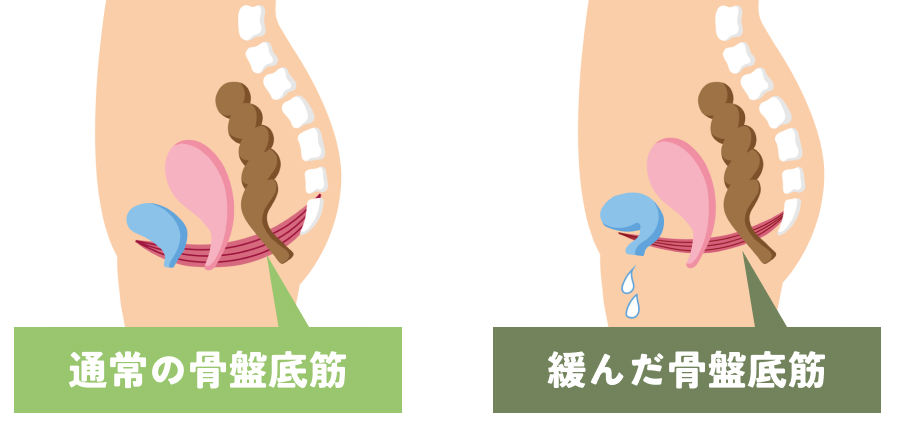 尿漏れとかかわりの深い骨盤底筋