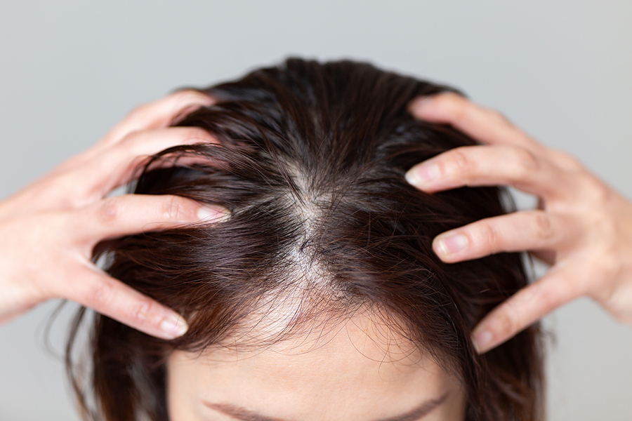 3. 神経をリセットする頭皮ほぐし