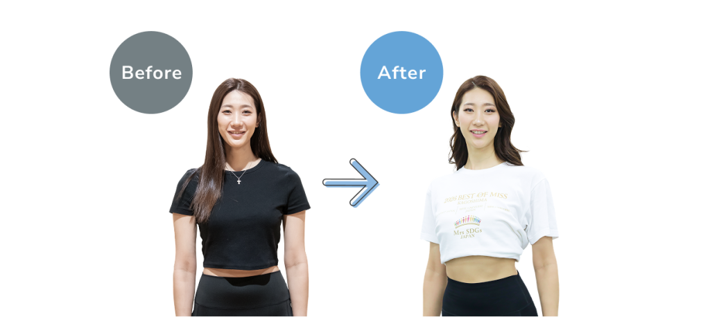 薗田さんBefore_After