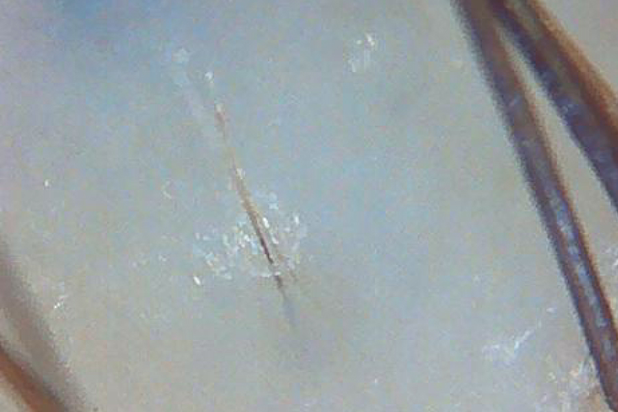 元の分け目に新しく生えてきた毛