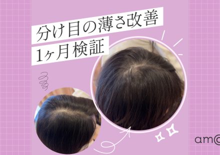 分け目の薄さ改善1ヶ月検証