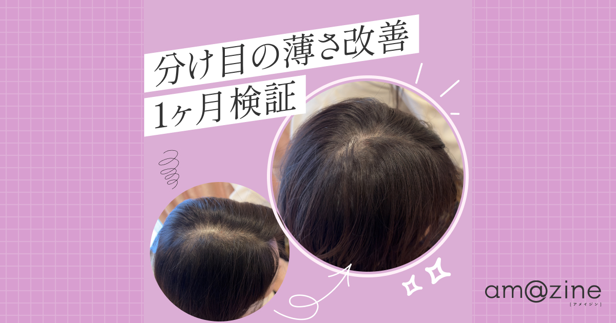 記事サムネイル