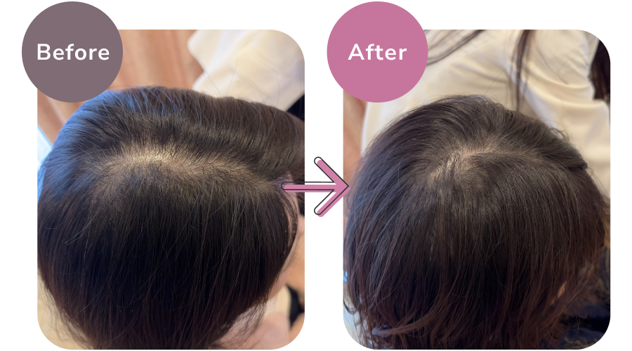 分け目の見た目のビフォーアフター