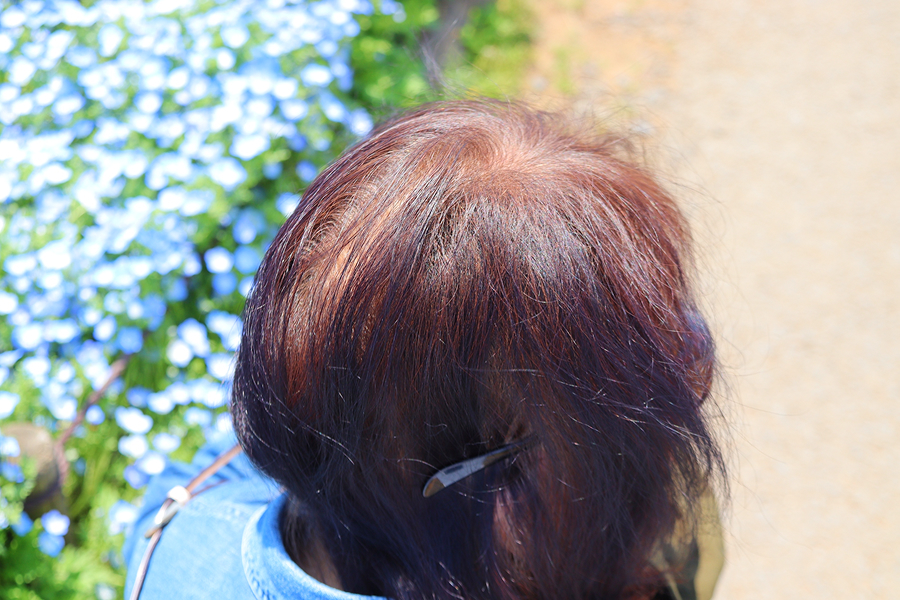 原因1.「10年同じ分け目」がダメージを蓄積させていた