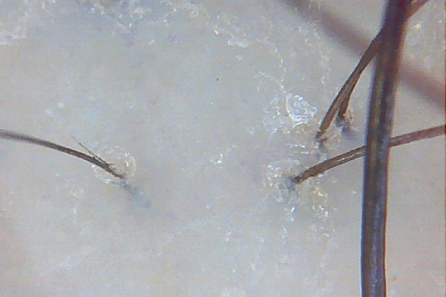 原因2.「頭皮の血行不良」が髪を育ちにくくしていた