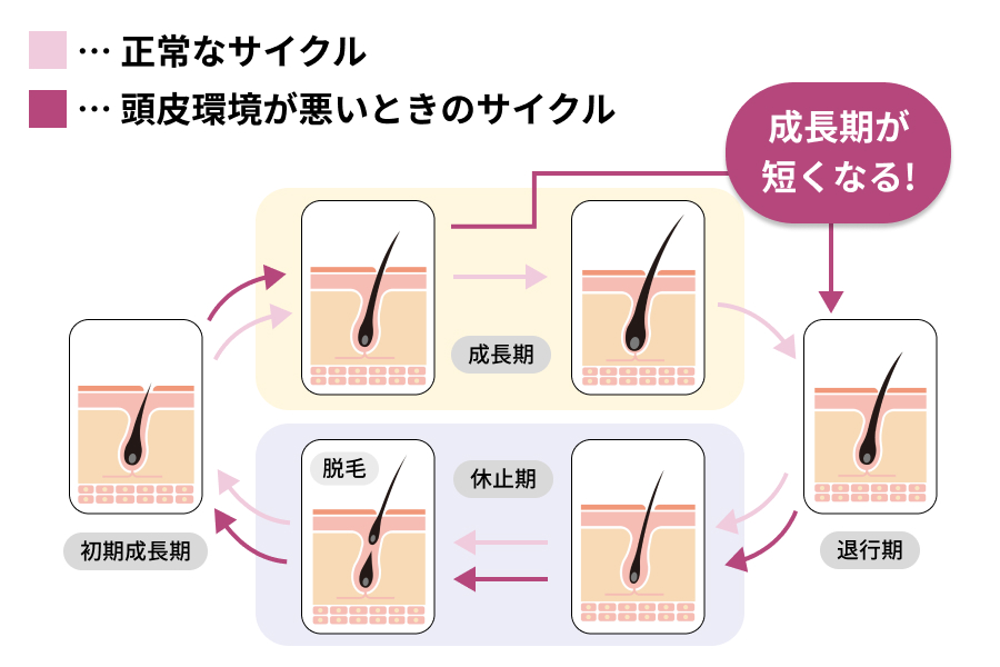 正常な時と、頭皮環境が悪いときの毛周期の違い