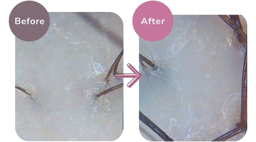 頭皮の色味のビフォーアフター