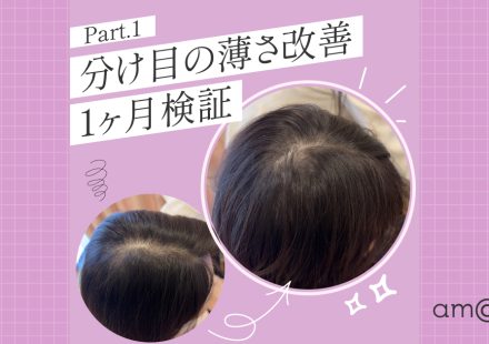 Part1_分け目の薄さ改善1ヶ月検証