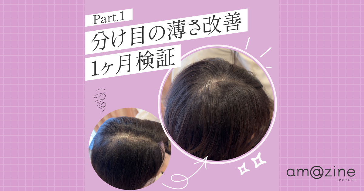 髪の分け目が薄い原因を毛髪診断士が解説！3つのケアを1ヶ月検証