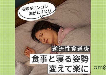 【医師監修】逆流性食道炎とは？若い人が急増中の原因と自宅でできる対策