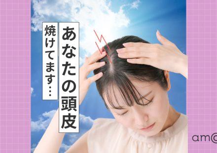 頭皮の日焼けが抜け毛の原因に？発毛技能士が教える対策とセルフケア