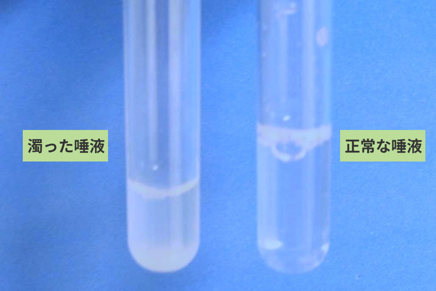 櫻井さん：唾液の質は、透明なコップなどに入れて見てみると確認できます。 正常な唾液は無色透明です。