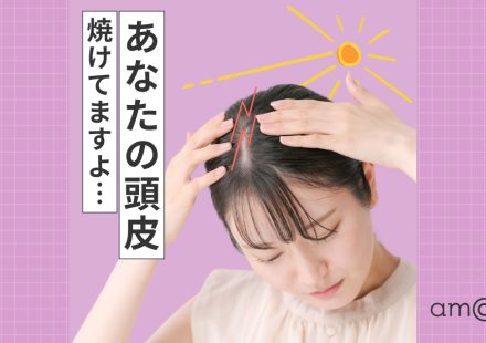 頭皮の日焼けが抜け毛の原因に？発毛技能士が教える対策とセルフケア