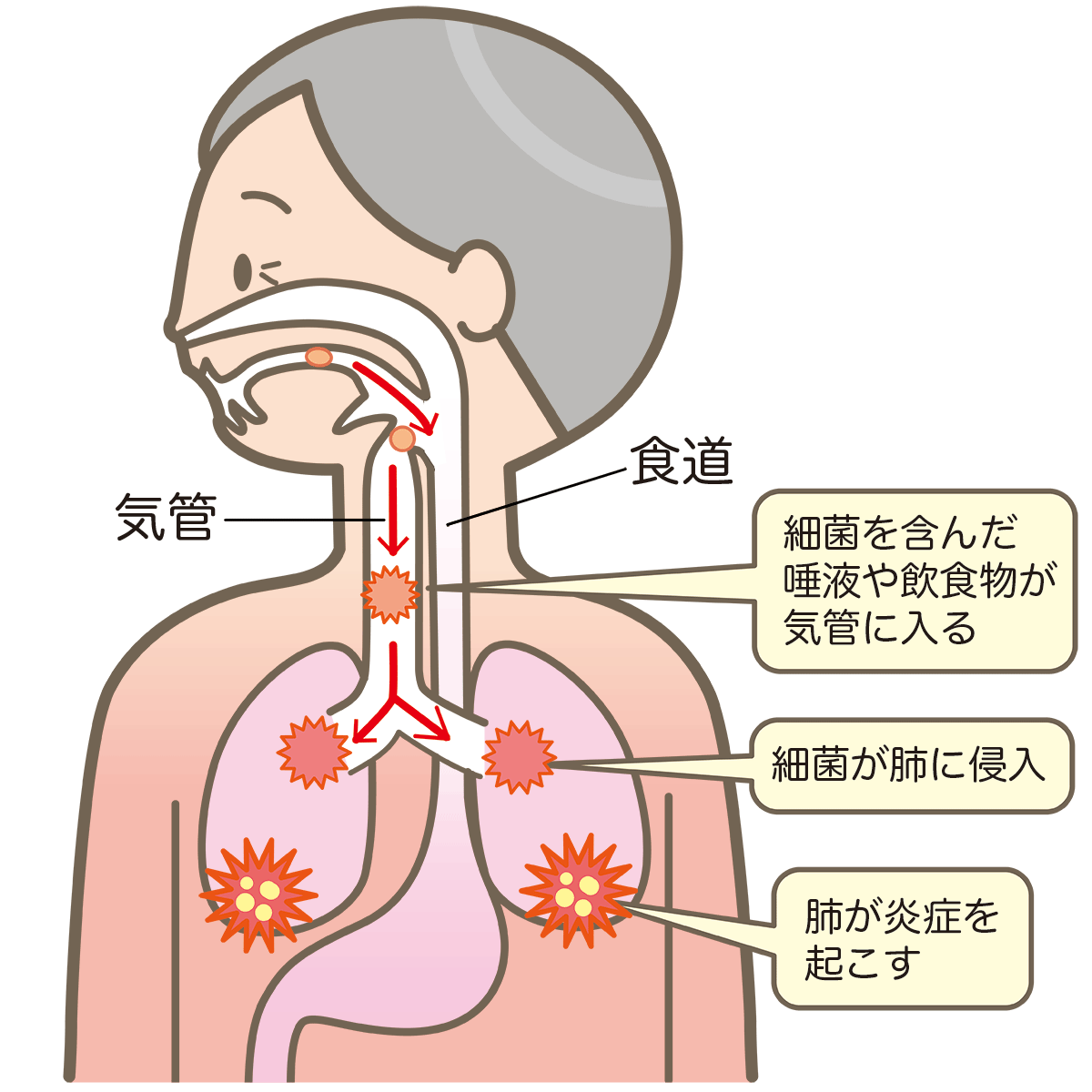 誤嚥性肺炎を予防するには 長息パイプ で毎日楽しく長生きトレーニング Amepla