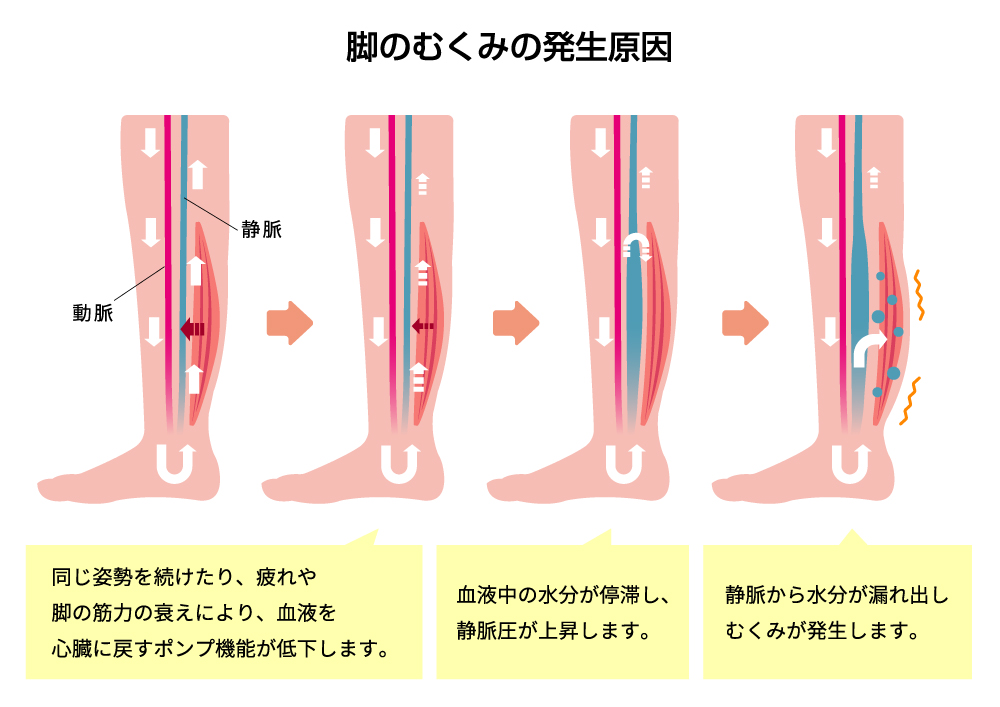 の むくみ 改善 足