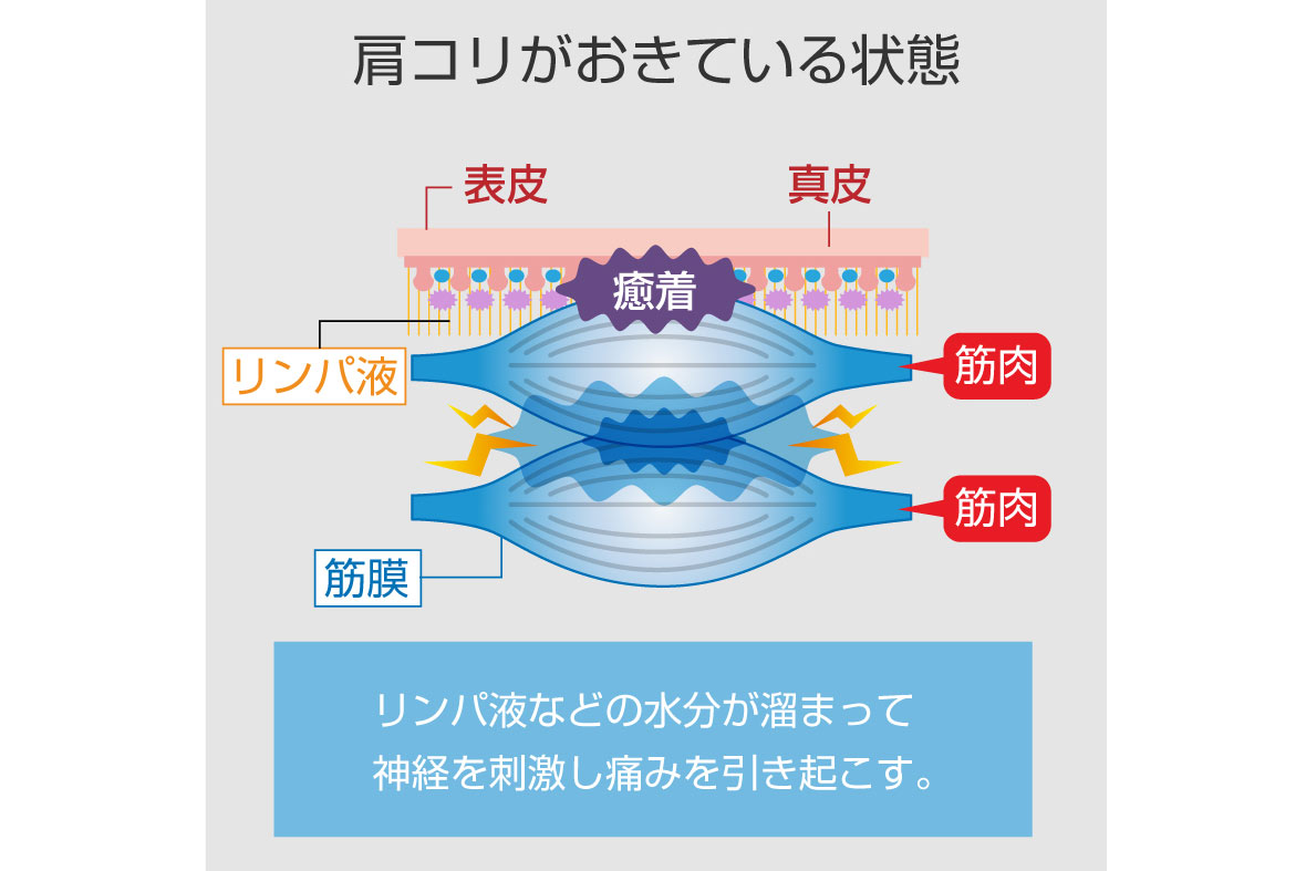 膜 リリース ガン 筋 整体師も薦めるマッサージガンとは？筋膜リリースで肩こり解消！