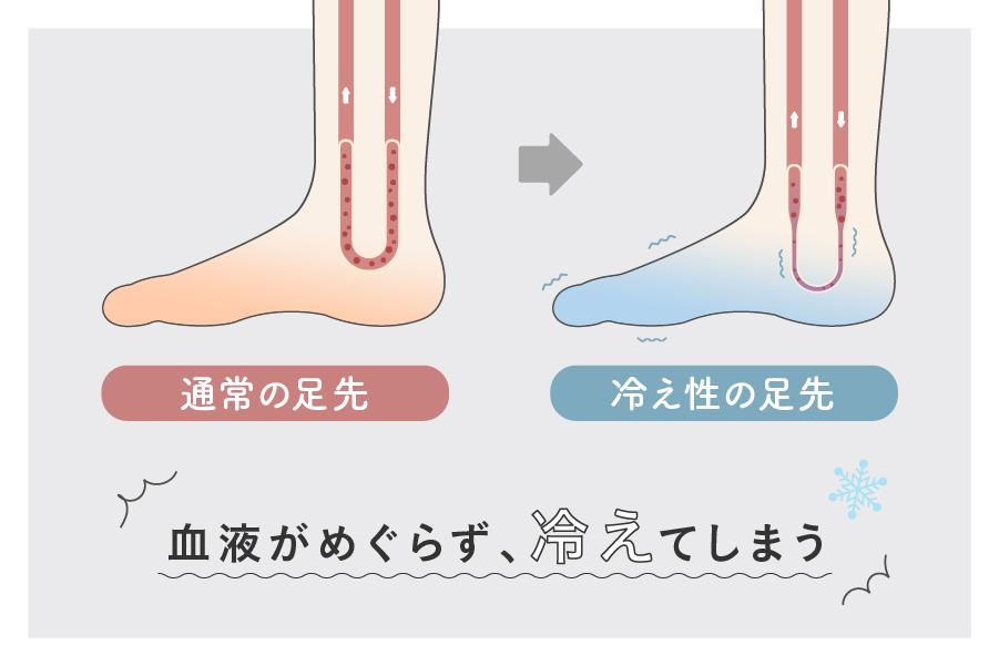 足が冷えて末端に血液が送られなくなる