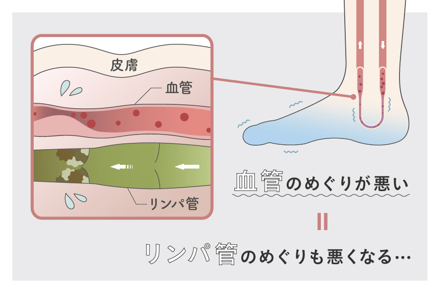 血管の巡りが悪い→リンパ管の巡りが悪い