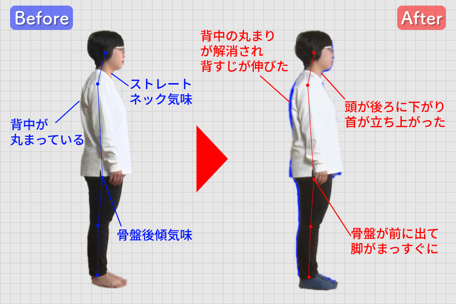 背中の丸まりが解消！