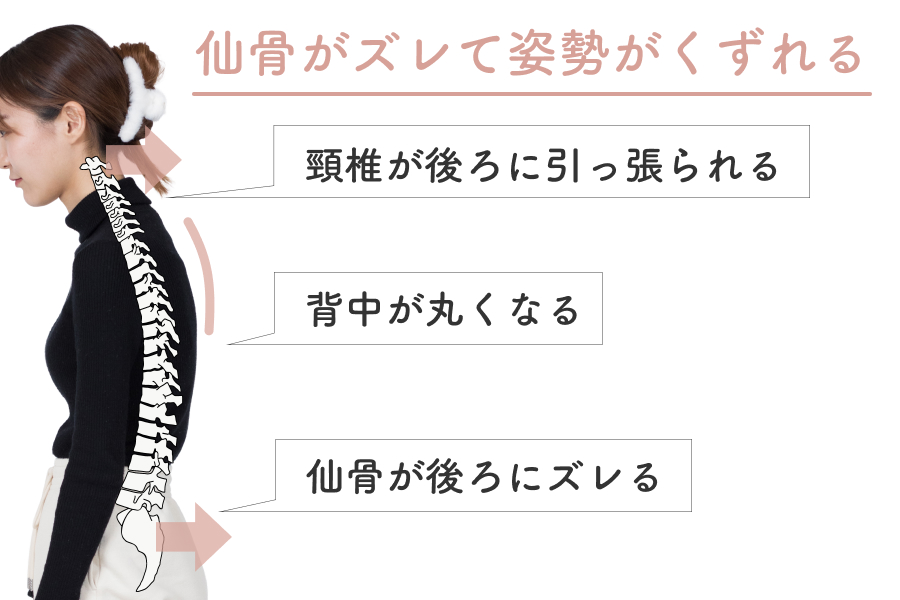 仙骨がズレて姿勢がくずれる